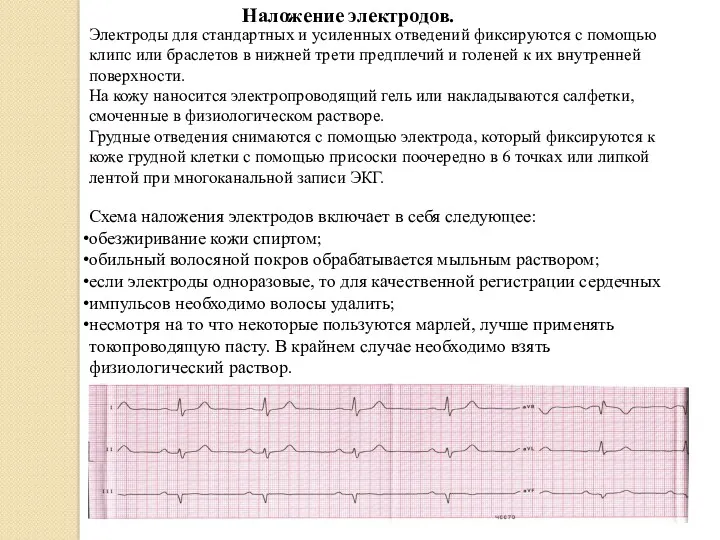 Электроды для стандартных и усиленных отведений фиксируются с помощью клипс