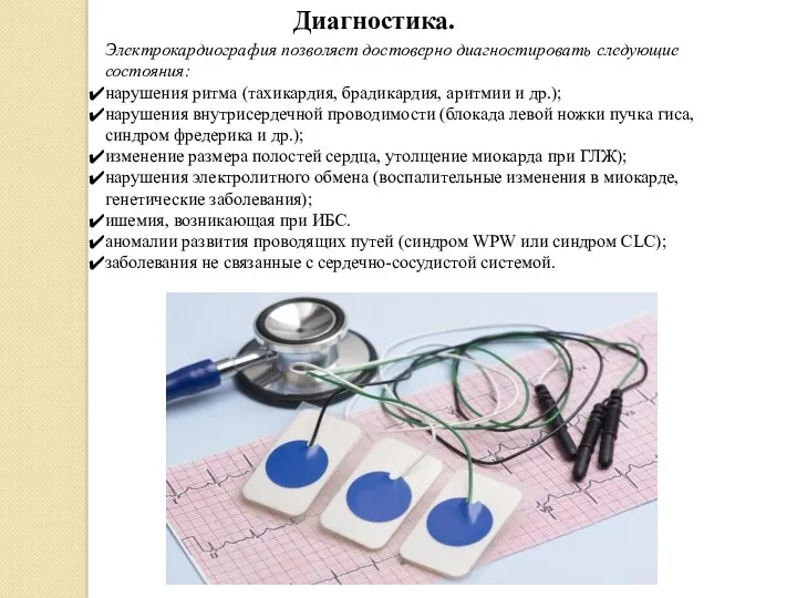 Электрокардиография позволяет достоверно диагностировать следующие состояния: нарушения ритма (тахикардия, брадикардия,