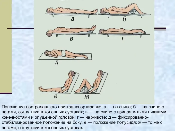 Положение пострадавшего при транспортировке: а — на спине; б —