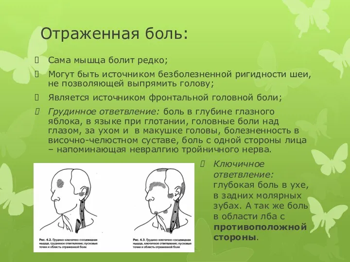 Отраженная боль: Сама мышца болит редко; Могут быть источником безболезненной