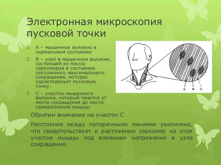 Электронная микроскопия пусковой точки Обратим внимание на участок С Расстояние