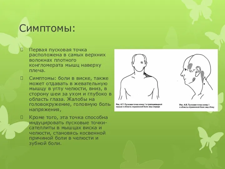 Симптомы: Первая пусковая точка расположена в самых верхних волокнах плотного