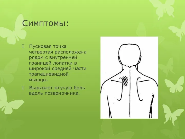 Симптомы: Пусковая точка четвертая расположена рядом с внутренней границей лопатки