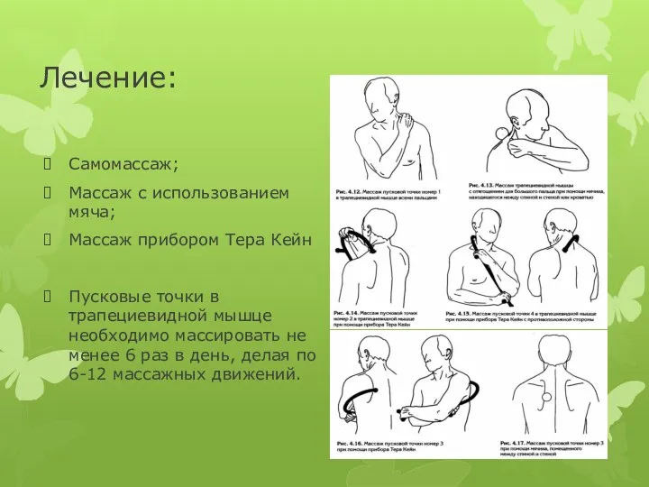 Лечение: Самомассаж; Массаж с использованием мяча; Массаж прибором Тера Кейн