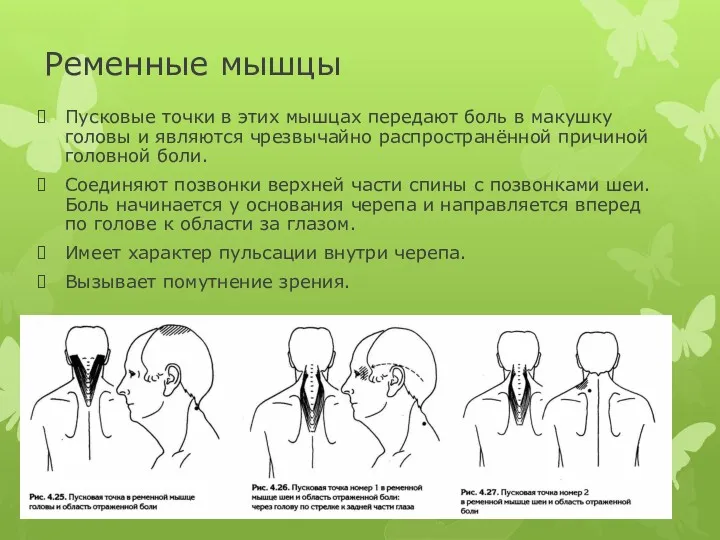 Ременные мышцы Пусковые точки в этих мышцах передают боль в