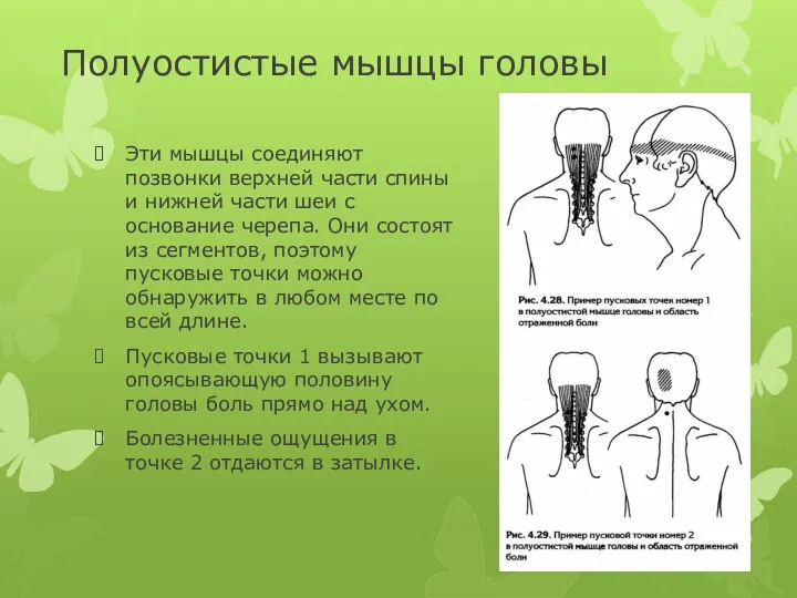 Полуостистые мышцы головы Эти мышцы соединяют позвонки верхней части спины