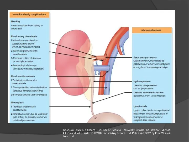 Transplantation at a Glance, First Edition. Menna Clatworthy, Christopher Watson,