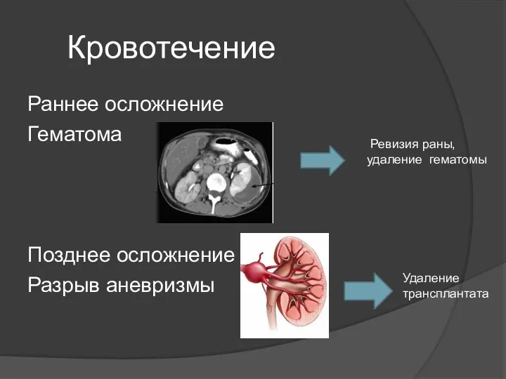 Кровотечение Раннее осложнение Гематома Позднее осложнение Разрыв аневризмы Ревизия раны, удаление гематомы Удаление трансплантата