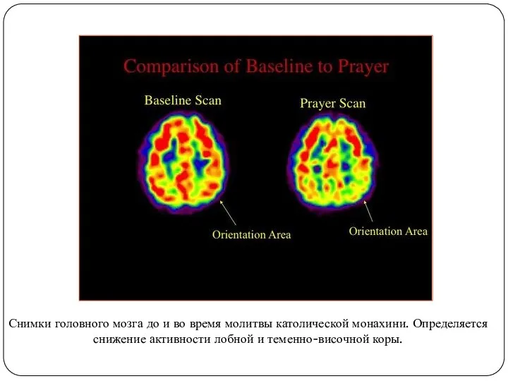 Снимки головного мозга до и во время молитвы католической монахини.