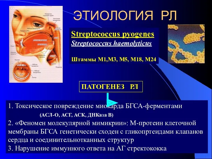 ЭТИОЛОГИЯ РЛ Streptococcus pyogenes Streptococcus haemolyticus Штаммы М1,М3, М5, М18,