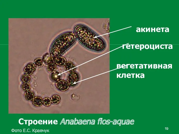 акинета гетероциста вегетативная клетка Строение Anabaena flos-aquae Фото Е.С. Кравчук