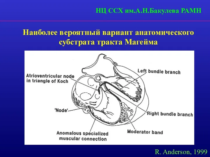 Наиболее вероятный вариант анатомического субстрата тракта Магейма R. Anderson, 1999 НЦ ССХ им.А.Н.Бакулева РАМН