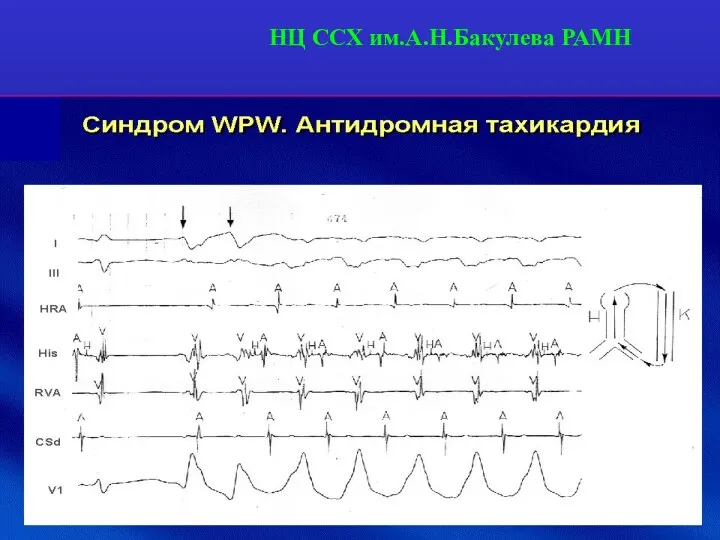 НЦ ССХ им.А.Н.Бакулева РАМН