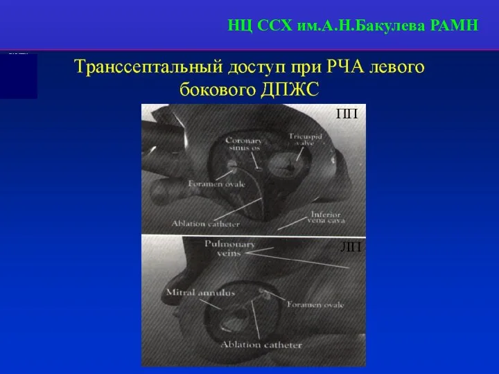 НЦ ССХ им.А.Н.Бакулева РАМН