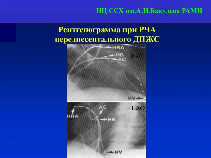 НЦ ССХ им.А.Н.Бакулева РАМН