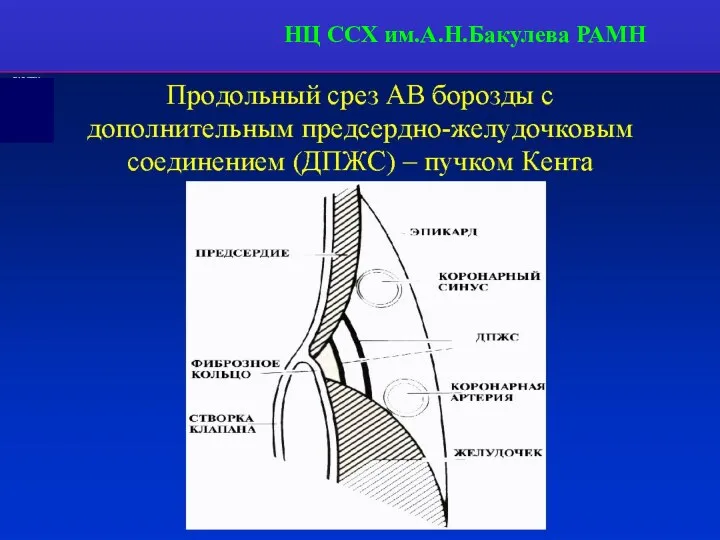 НЦ ССХ им.А.Н.Бакулева РАМН