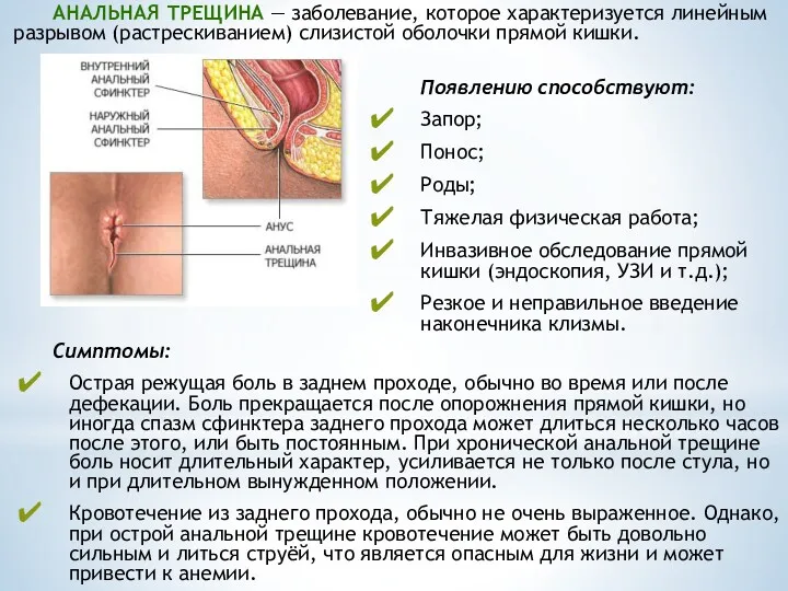 АНАЛЬНАЯ ТРЕЩИНА — заболевание, которое характеризуется линейным разрывом (растрескиванием) слизистой