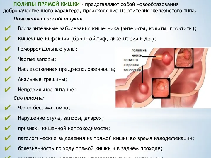 ПОЛИПЫ ПРЯМОЙ КИШКИ - представляют собой новообразования доброкачественного характера, происходящие