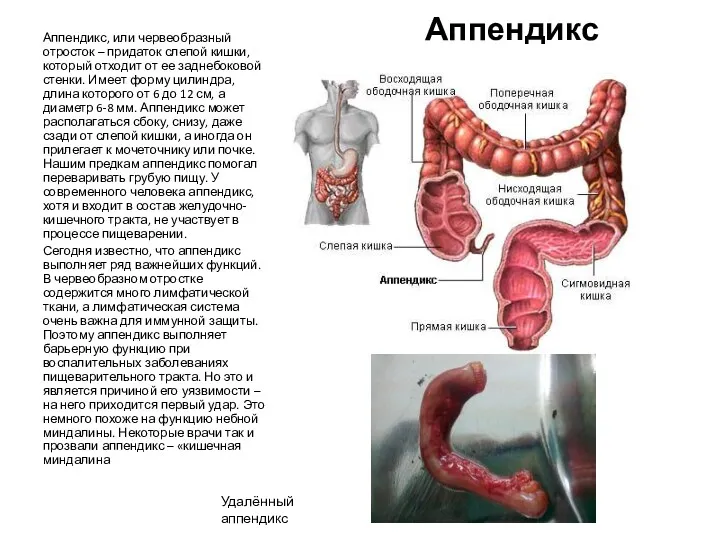 Аппендикс Аппендикс, или червеобразный отросток – придаток слепой кишки, который