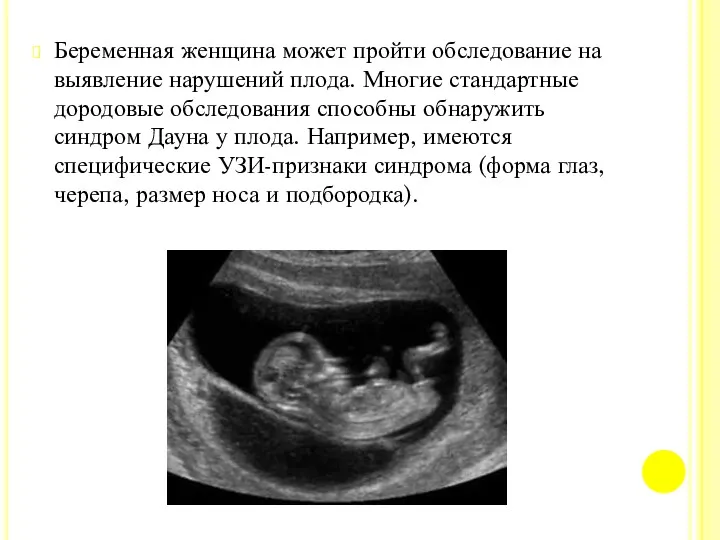 Беременная женщина может пройти обследование на выявление нарушений плода. Многие