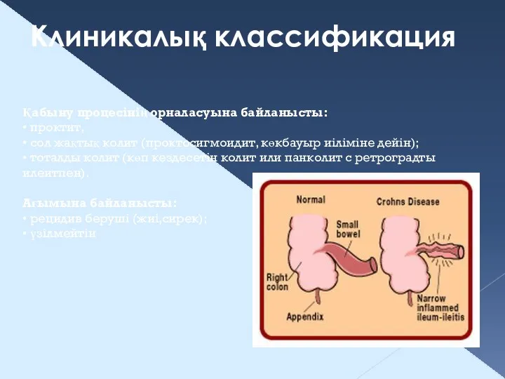 Клиникалық классификация Қабыну процесінің орналасуына байланысты: • проктит, • сол