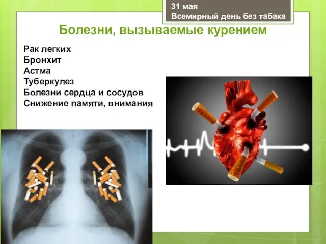 Рак легких Бронхит Астма Туберкулез Болезни сердца и сосудов Снижение