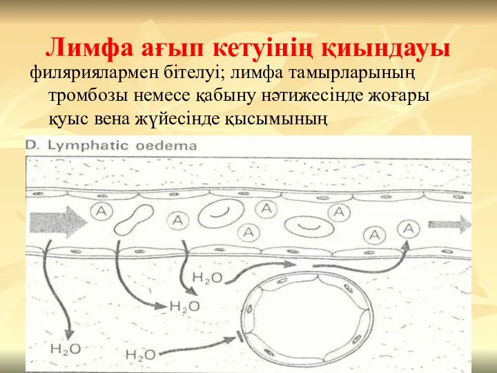 Лимфа ағып кетуінің қиындауы филяриялармен бітелуі; лимфа тамырларының тромбозы немесе