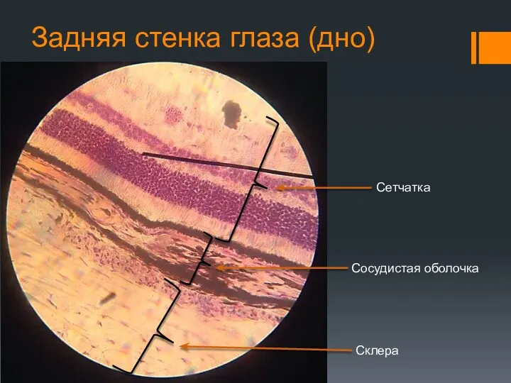 Задняя стенка глаза (дно) Сетчатка Сосудистая оболочка Склера