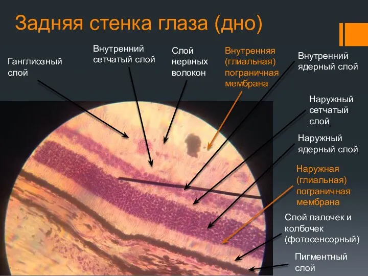 Задняя стенка глаза (дно) Пигментный слой Слой палочек и колбочек (фотосенсорный) Наружная (глиальная)