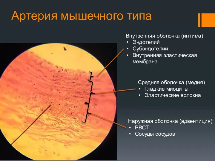 Артерия мышечного типа Внутренняя оболочка (интима) Эндотелий Субэндотелий Внутренняя эластическая