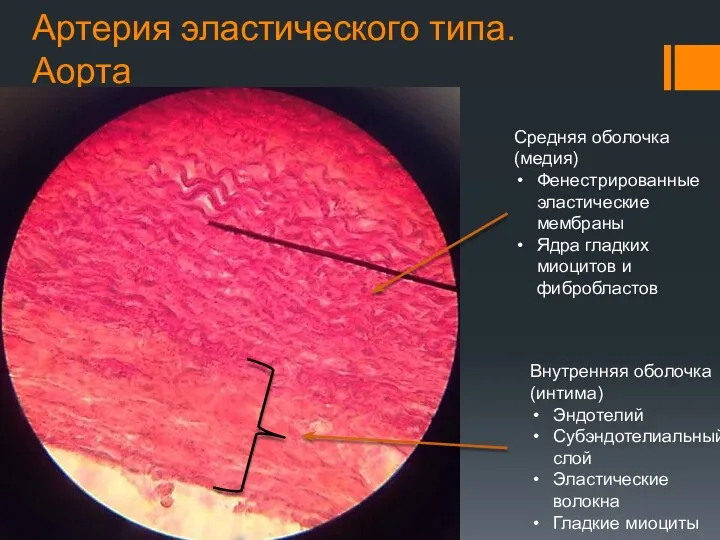 Артерия эластического типа. Аорта Внутренняя оболочка (интима) Эндотелий Субэндотелиальный слой