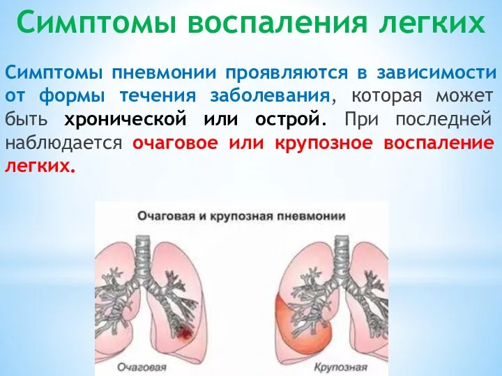 Симптомы воспаления легких Симптомы пневмонии проявляются в зависимости от формы