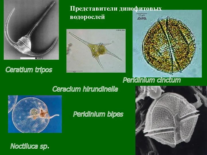 Peridinium cinctum Peridinium bipes Ceratium tripos Представители динофитовых водорослей Ceracium hirundinella Noctiluca sp.