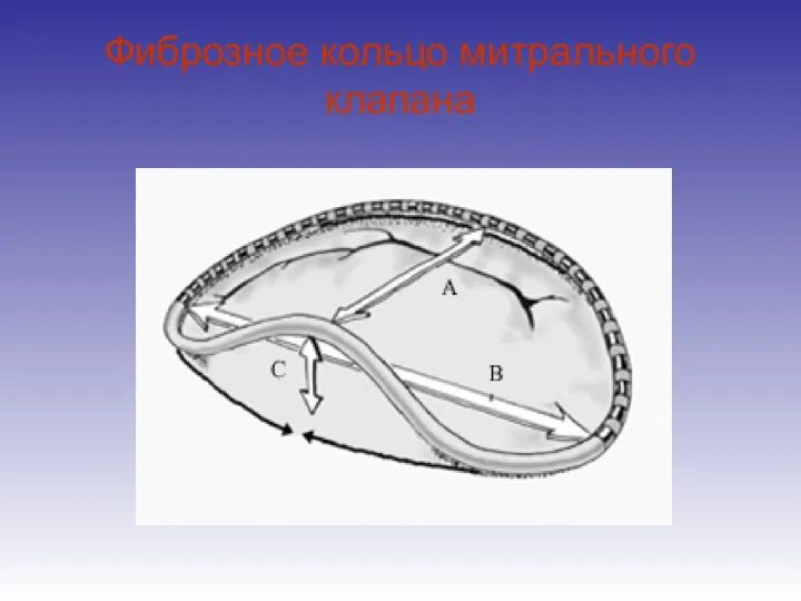 Фиброзное кольцо митрального клапана