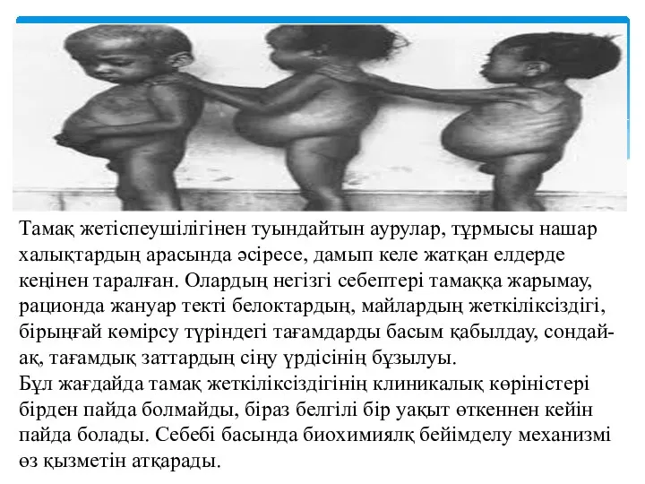 Тамақ жетіспеушілігінен туындайтын аурулар, тұрмысы нашар халықтардың арасында әсіресе, дамып