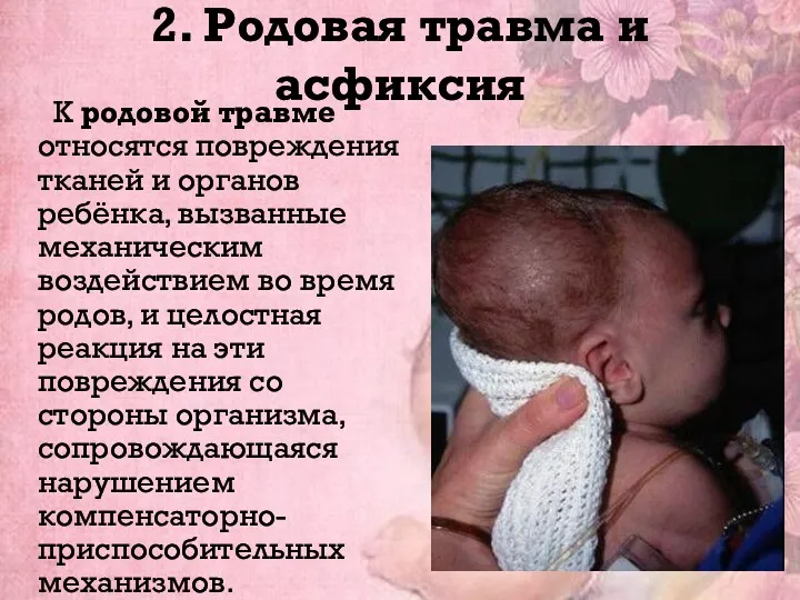 2. Родовая травма и асфиксия К родовой травме относятся повреждения