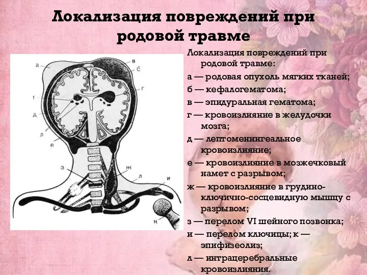 Локализация повреждений при родовой травме Локализация повреждений при родовой травме: