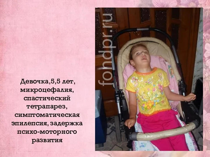 Девочка,5,5 лет, микроцефалия, спастический тетрапарез, симптоматическая эпилепсия, задержка психо-моторного развития