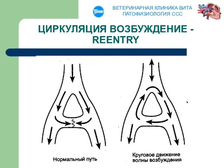 ЦИРКУЛЯЦИЯ ВОЗБУЖДЕНИЕ - REENTRY