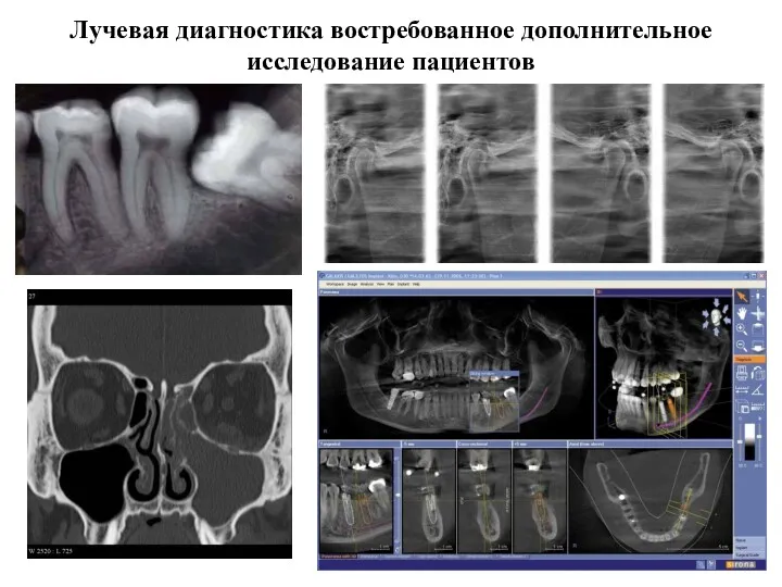 Лучевая диагностика востребованное дополнительное исследование пациентов