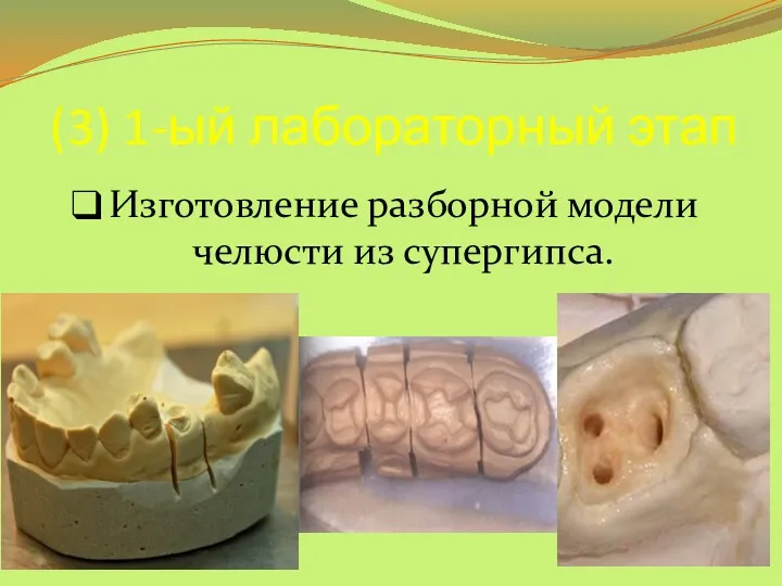 (3) 1-ый лабораторный этап Изготовление разборной модели челюсти из супергипса.