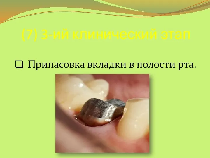 (7) 3-ий клинический этап Припасовка вкладки в полости рта.