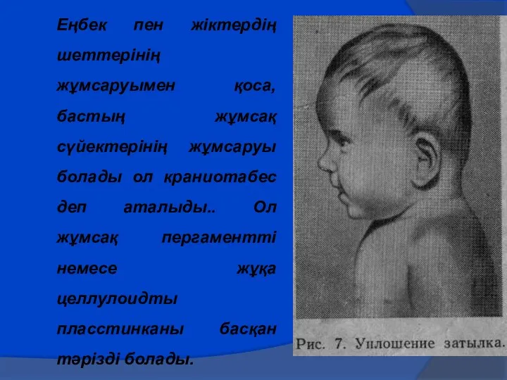 Еңбек пен жіктердің шеттерінің жұмсаруымен қоса, бастың жұмсақ сүйектерінің жұмсаруы болады ол краниотабес