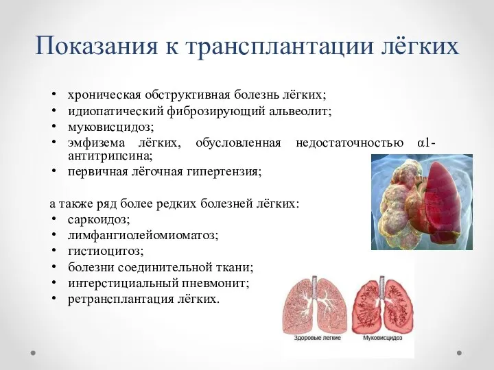 Показания к трансплантации лёгких хроническая обструктивная болезнь лёгких; идиопатический фиброзирующий альвеолит; муковисцидоз; эмфизема