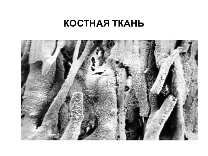 КОСТНАЯ ТКАНЬ