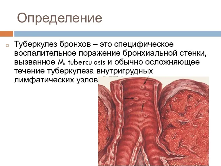 Определение Туберкулез бронхов – это специфическое воспалительное поражение бронхиальной стенки,