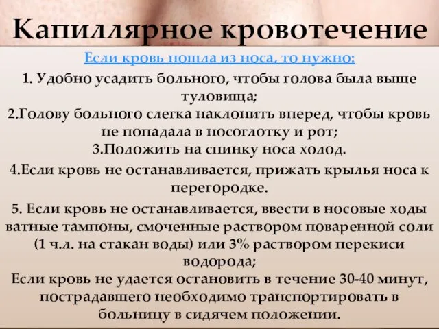 Капиллярное кровотечение Кровотечение поверхностное, кровь сочится из раны, вытекает в