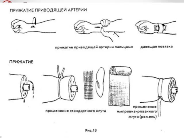 Расположение крупных артерий