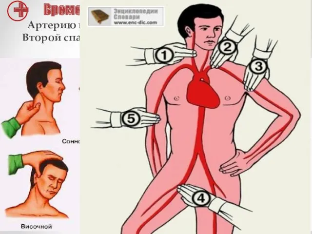 Артерию выше места ранения зажмите пальцем. Второй спасатель в это время готовит средства для остановки кровотечения