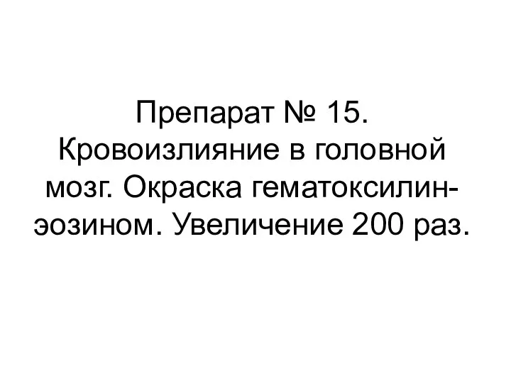 Препарат № 15. Кровоизлияние в головной мозг. Окраска гематоксилин-эозином. Увеличение 200 раз.